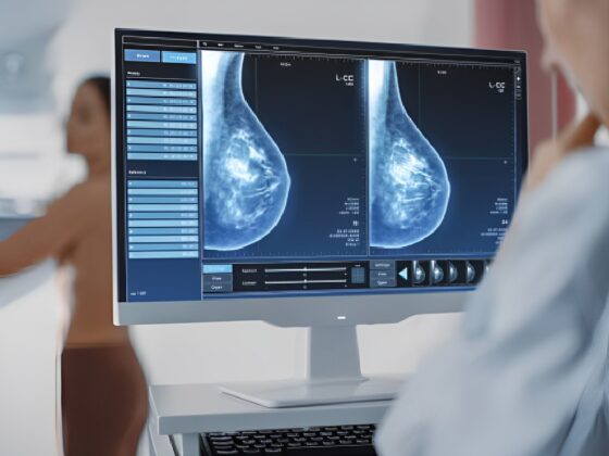 No diagnosticar el cáncer de mama resulta en un acuerdo confidencial 1