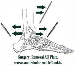 newsletter-iii-surgerypic